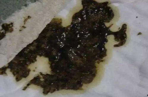 吃瓜大便颜色绿,揭秘吃瓜大便的神秘色彩